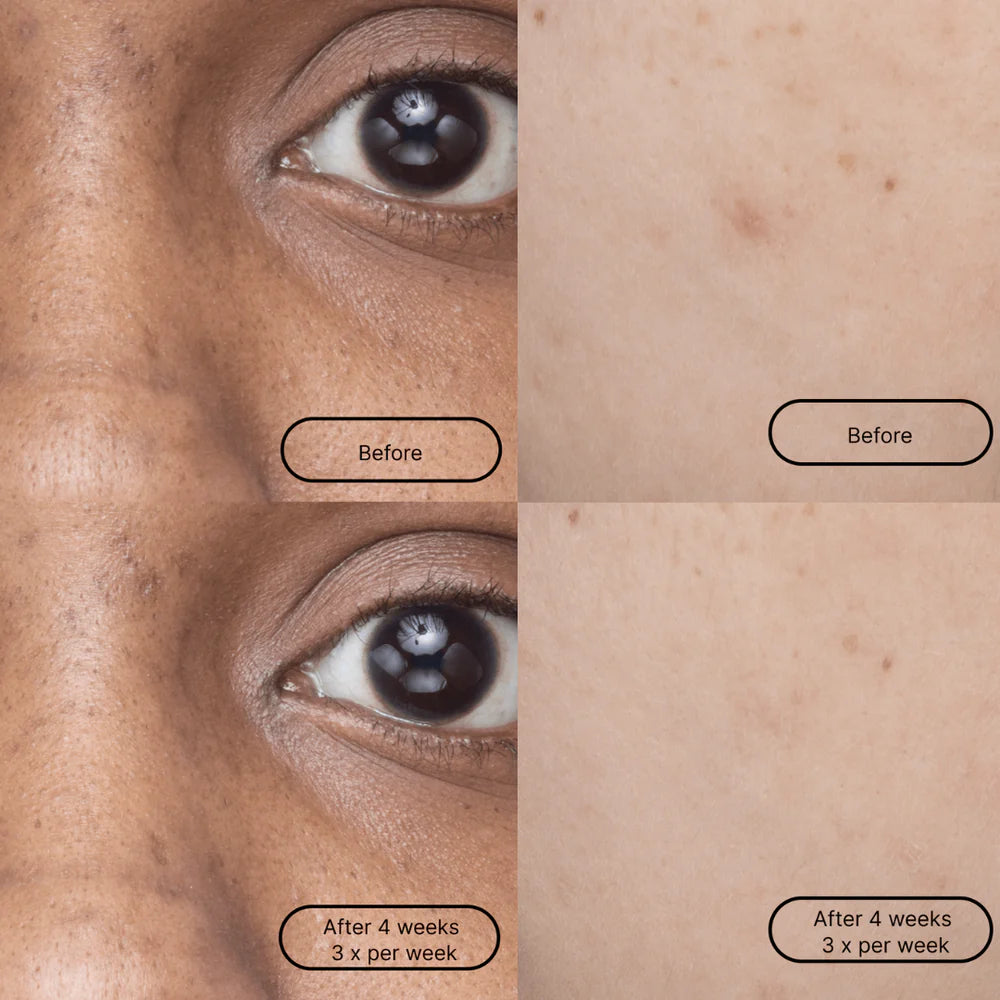 
                      
                        Face Masks - Hyper Smooth Set of 5 [PRE ORDER]
                      
                    